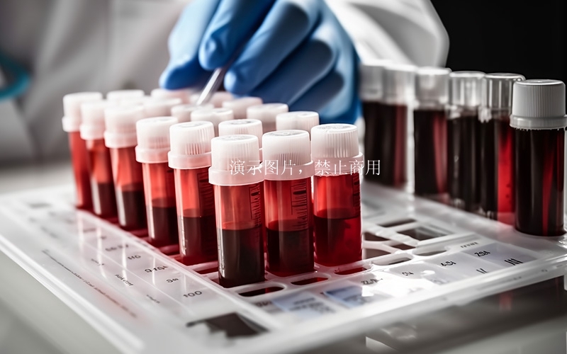 常規(guī)血液系列